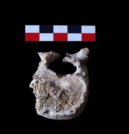 vertebra caius larcius felix